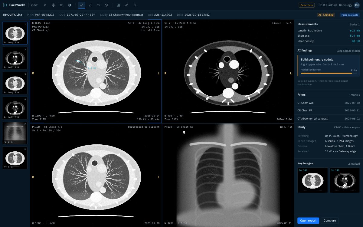 PacsWorks View showing a chest CT in lung and soft-tissue windows, the prior CT, a prior chest X-ray and an AI finding
